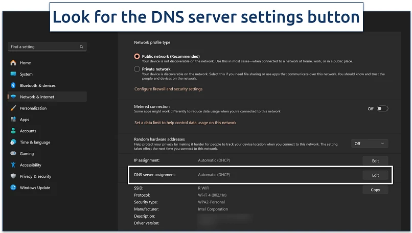 Screenshot of the Windows DNS settings